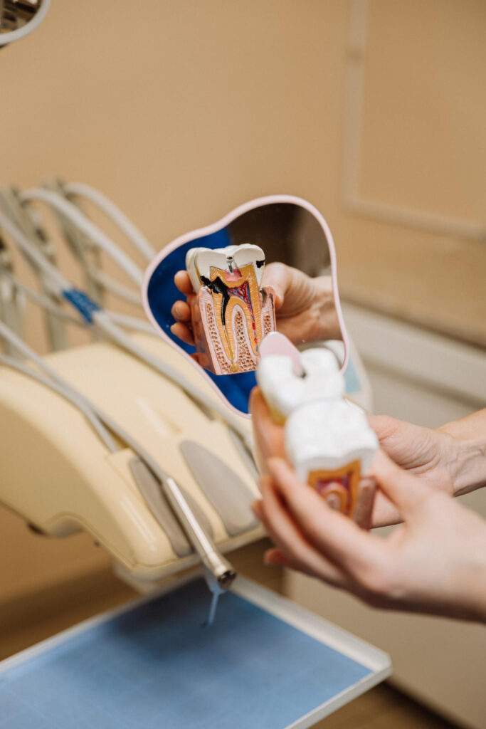 Endodoncia en Villaverde