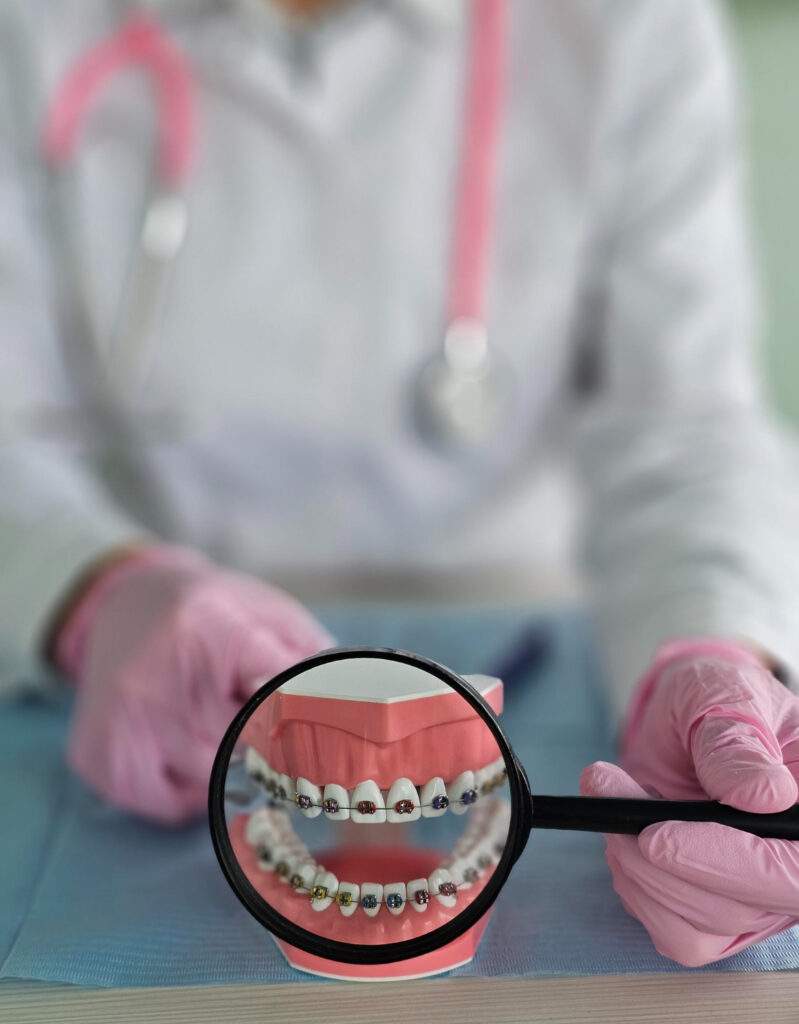 Ortodoncia con brackets en Villaverde